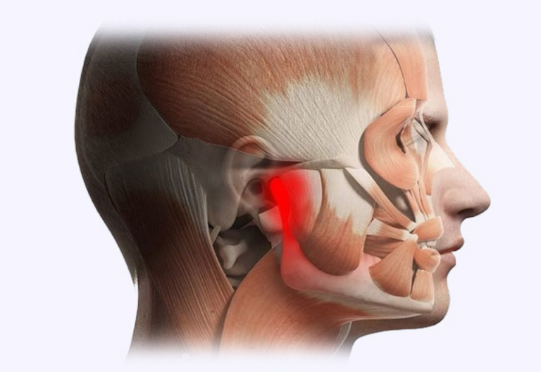 Temporomandibular Joint Dysfunction Cause And Symptom