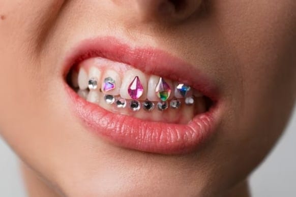 how long tooth gems last