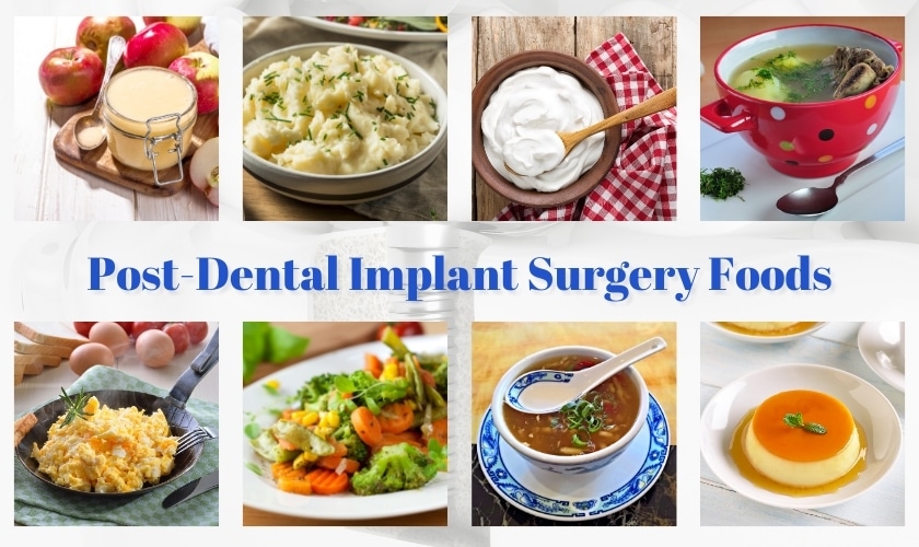 after dental implant surgery foods