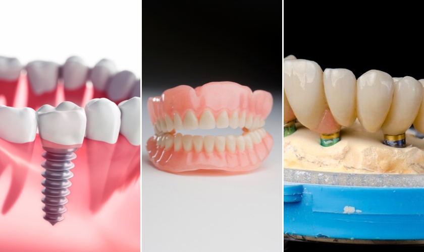 dental options for replacing missing teeth