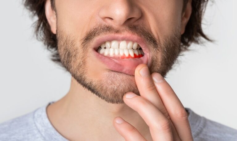 Fight A Tooth Infection Without Antibiotics