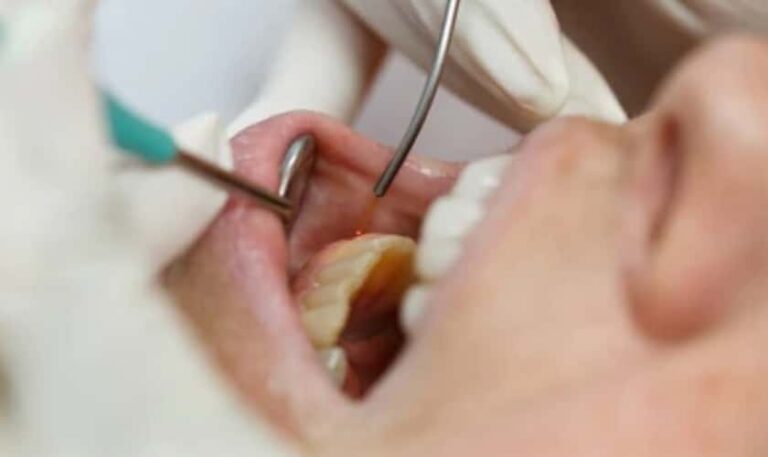 Laser Gum Surgery Can Help Treat Gum Disease