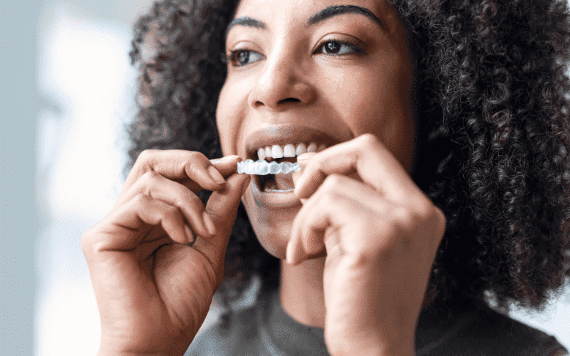 First Week With Invisalign