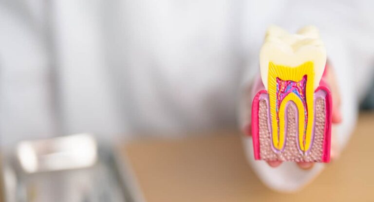 How To Care For Your Tooth After A Root Canal In Katy