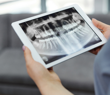 A dental professional holding a digital tablet displaying a dental X-ray image, representing advanced dental technology for a beautiful smile in Katy.