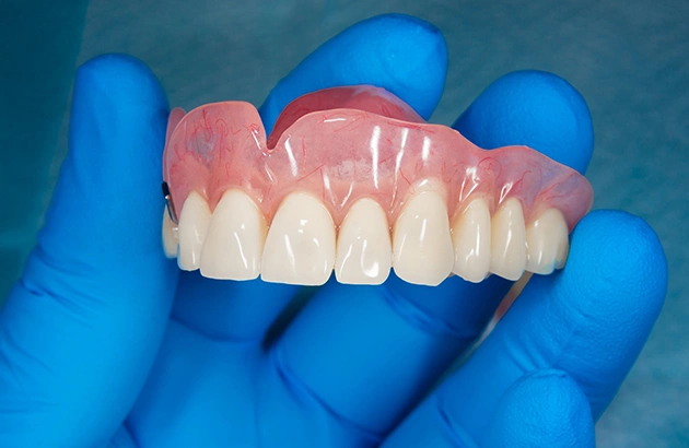 Close-up of a person wearing blue gloves holding a set of upper dentures, showcasing the realistic gum and teeth design intended for dental solutions in Cypress, TX. Keywords: expert dentures, Cypress TX, complete dentures, partial dentures.