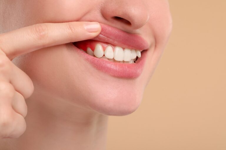 Gum-Disease-Treatment-Solutions-In-Cypress