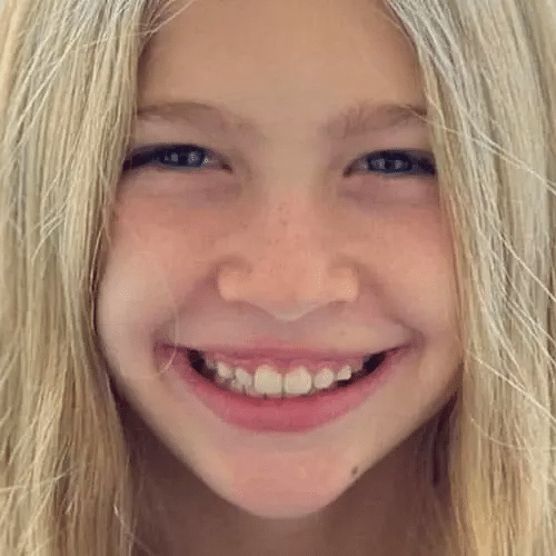 Invisalign Aligners1 12 Smiling Teenage Girl Looking Toward The Camera
