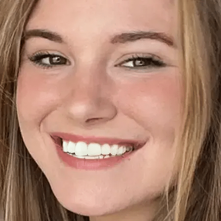 Invisalign Aligners1 13 Smiling Blond Teenage Girl With A Bright Open Smile